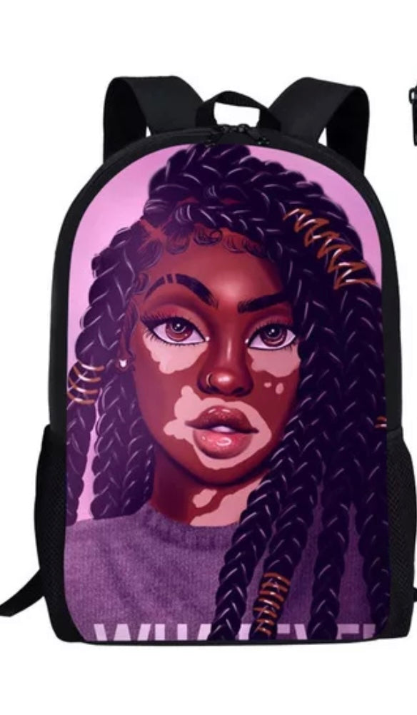 Beautiful Vitiligo Queen Backpack